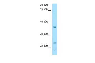 Western Blot: DTD1 Antibody [NBP2-87305]