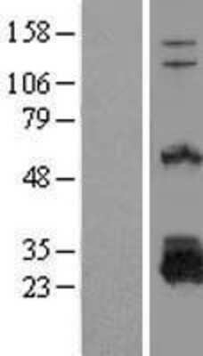 Western Blot: DTD1 Overexpression Lysate [NBL1-10030]