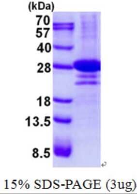 SDS-PAGE: Recombinant Human DTD1 His Protein [NBP2-23008]