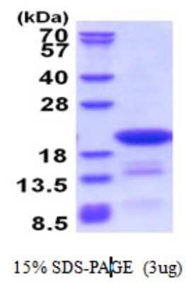 SDS-PAGE: Recombinant Human DTD2 His Protein [NBP2-51523]