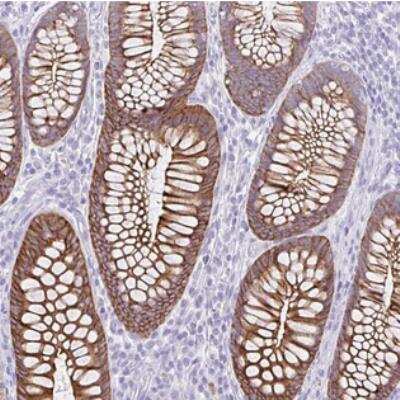 Immunohistochemistry: DTW Domain Containing 2 Antibody [NBP2-30634]