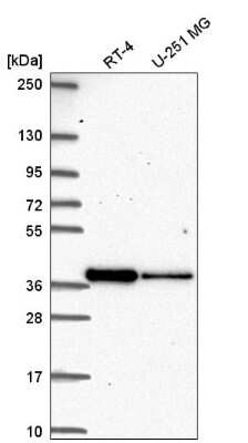 Western Blot: DTW Domain Containing 2 Antibody [NBP2-58397]