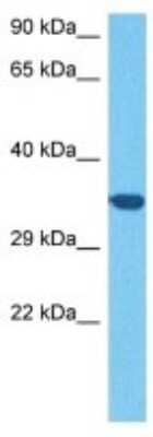 Western Blot: DTW Domain Containing 2 Antibody [NBP3-10850]