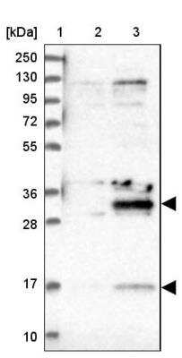 Western Blot: DTWD1 Antibody [NBP2-30570]