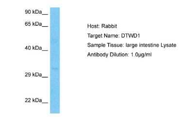 Western Blot: DTWD1 Antibody [NBP2-82929]