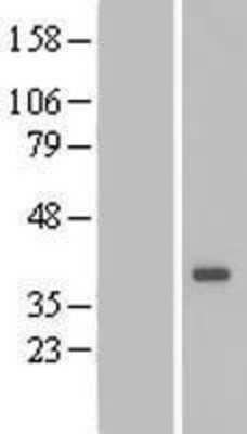 Western Blot: DTWD1 Overexpression Lysate [NBP2-06670]