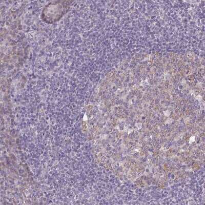 Immunohistochemistry-Paraffin: DTX1 Antibody [NBP2-58472]