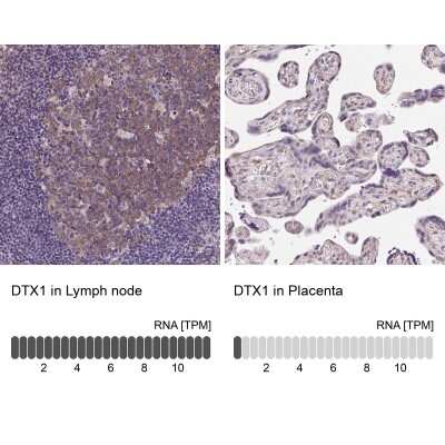 Immunohistochemistry-Paraffin: DTX1 Antibody [NBP2-58472]
