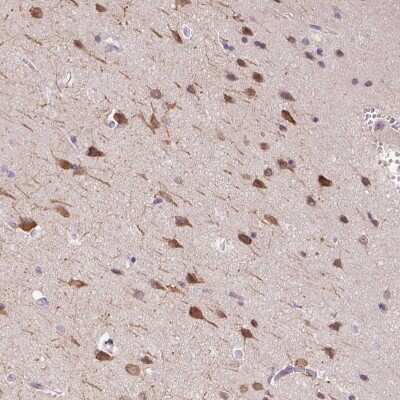 Immunohistochemistry-Paraffin: DTX1 Antibody [NBP2-58472]