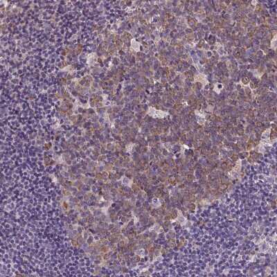 Immunohistochemistry-Paraffin: DTX1 Antibody [NBP2-58472]