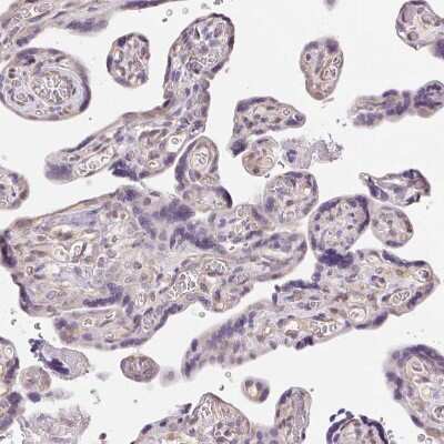 Immunohistochemistry-Paraffin: DTX1 Antibody [NBP2-58472]