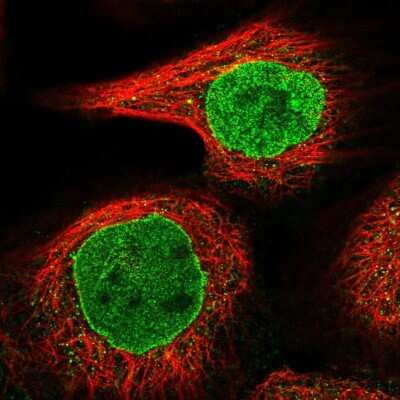 Immunocytochemistry/ Immunofluorescence: DTX2 Antibody [NBP2-13941]