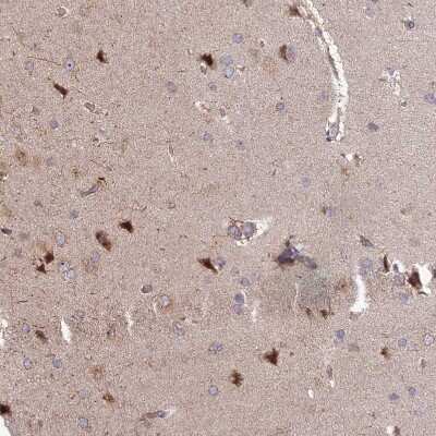 Immunohistochemistry-Paraffin: DTX2 Antibody [NBP2-13941]