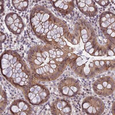 Immunohistochemistry-Paraffin: DTX2 Antibody [NBP2-13941]