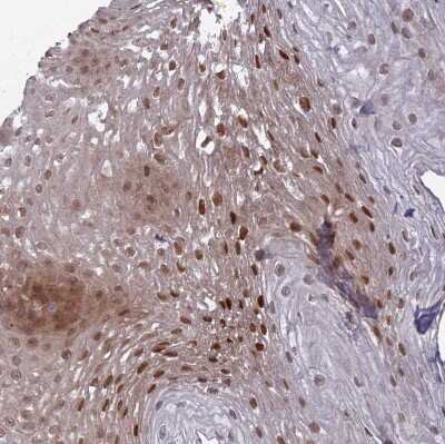 Immunohistochemistry-Paraffin: DTX2 Antibody [NBP2-13941]