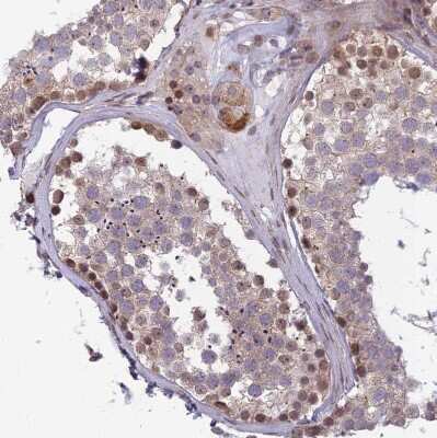 Immunohistochemistry-Paraffin: DTX2 Antibody [NBP2-13941]