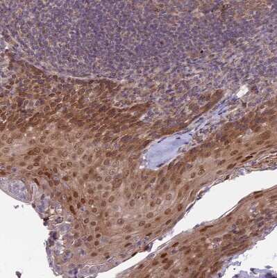 Immunohistochemistry-Paraffin: DTX2 Antibody [NBP2-13941]