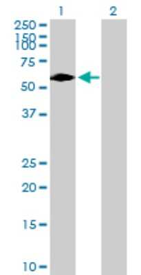 Western Blot: DTX2 Antibody [H00113878-B01P]