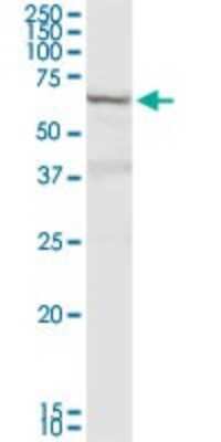 Western Blot: DTX2 Antibody [H00113878-D01P]
