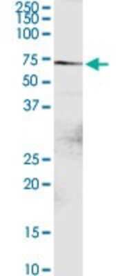 Western Blot: DTX2 Antibody [H00113878-D01P]