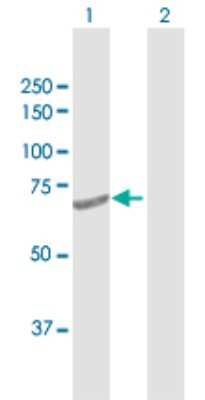 Western Blot: DTX2 Antibody [H00113878-D01P]
