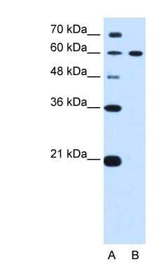 Western Blot: DTX2 Antibody [NBP1-53119]