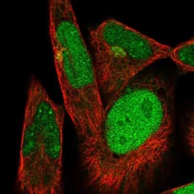 Immunocytochemistry/ Immunofluorescence: DTX3 Antibody [NBP2-31789]