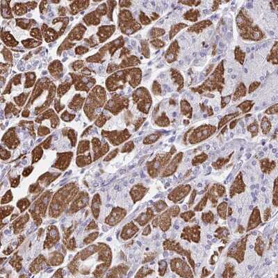 Immunohistochemistry-Paraffin: DTX3 Antibody [NBP2-31789]