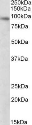 Western Blot: DTX3 Antibody [NBP1-46127]