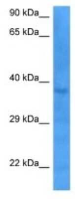 Western Blot: DTX3 Antibody [NBP3-10787]