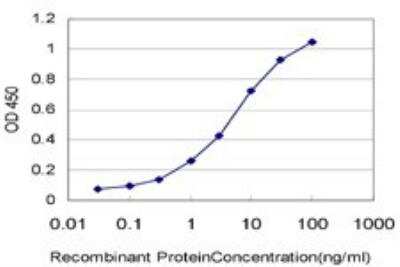 ELISA: DTX3L Antibody (1D10) [H00151636-M01]