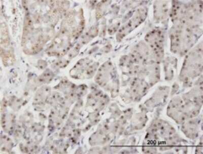 Immunohistochemistry-Paraffin: DTX3L Antibody (1D10) [H00151636-M01]