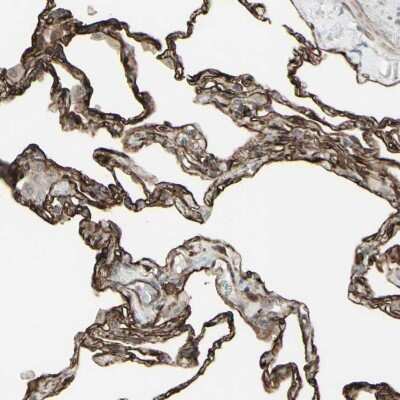 Immunohistochemistry-Paraffin: DTX3L Antibody [NBP1-88699]