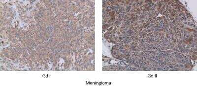 Immunohistochemistry-Paraffin: DTX3L Antibody [NBP1-88699]