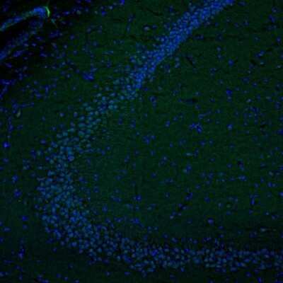 Immunocytochemistry/ Immunofluorescence: DTX4 Antibody [NBP2-32448]