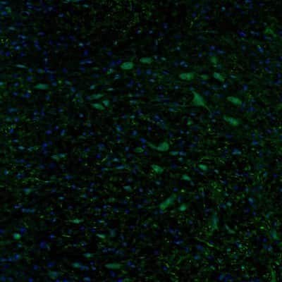 Immunocytochemistry/ Immunofluorescence: DTX4 Antibody [NBP2-32448]