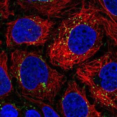 Immunocytochemistry/ Immunofluorescence: DTX4 Antibody [NBP2-32448]