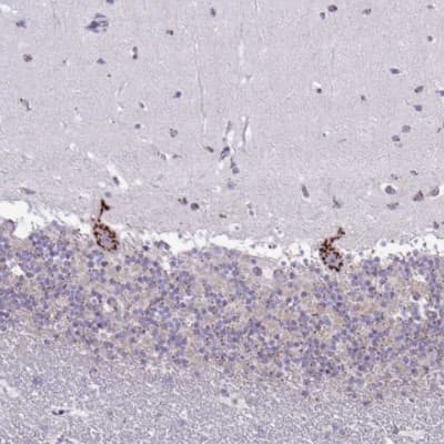 Immunohistochemistry-Paraffin: DTX4 Antibody [NBP2-32448]