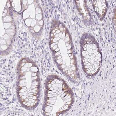 Immunohistochemistry-Paraffin: DTX4 Antibody [NBP2-34161]