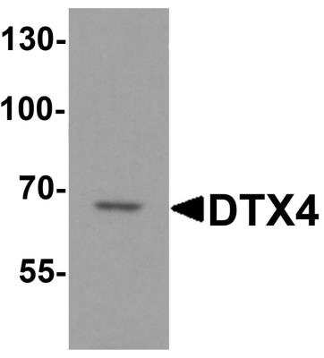 Western Blot: DTX4 AntibodyBSA Free [NBP2-81924]