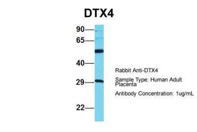 Western Blot: DTX4 Antibody [NBP2-84824]