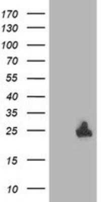 Western Blot: DTYMK Antibody (OTI1G8) [NBP2-01184]