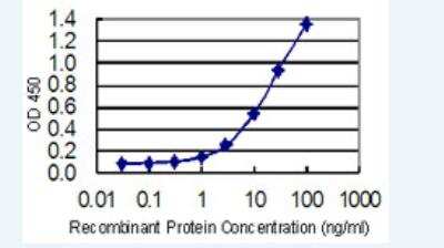 ELISA: DTYMK Antibody (2G11) [H00001841-M02-100ug]