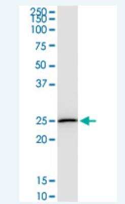 Western Blot: DTYMK Antibody (2G11) [H00001841-M02-100ug]