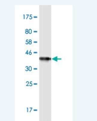 Western Blot: DTYMK Antibody (2G11) [H00001841-M02-100ug]