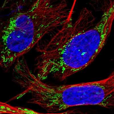 Immunocytochemistry/ Immunofluorescence: DTYMK Antibody [NBP1-91851]