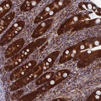 Immunohistochemistry-Paraffin: DTYMK Antibody [NBP1-91850]