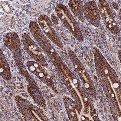 Immunohistochemistry-Paraffin: DTYMK Antibody [NBP1-91851]