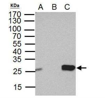 Immunoprecipitation: DTYMK Antibody [NBP2-16231]