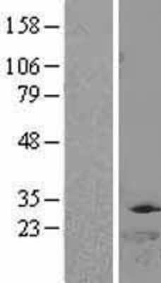 Western Blot: DTYMK Overexpression Lysate [NBL1-10039]